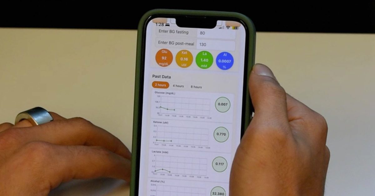 Chytrý prsten měřící krevní cukr z potu propojený s iPhonem
